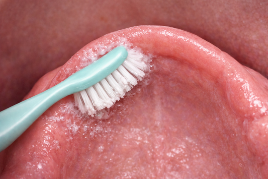 D.H.Denture & Mouth Adhesive Remover Paste