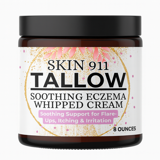 Skin 911 – Tallow Soothing Eczema Whipped Cream | Natural Relief